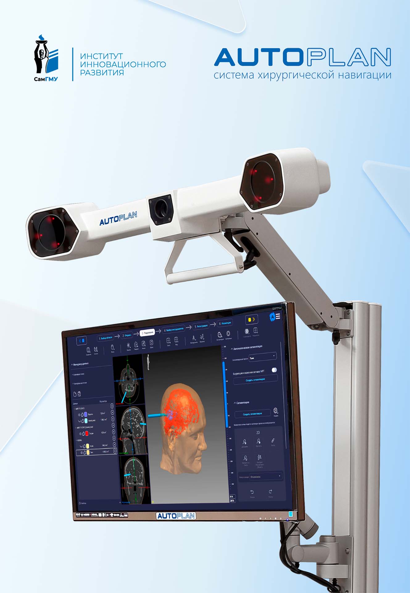 Система хирургической навигации AUTOPLAN в эфире ОТВ-Прим