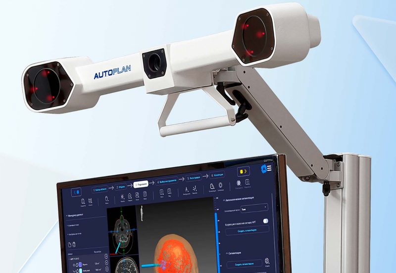 Система хирургической навигации AUTOPLAN в эфире ОТВ-Прим